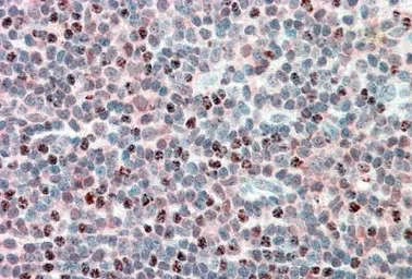 Anti-PSMB10 antibody, Internal used in IHC (Paraffin sections) (IHC-P). GTX88408
