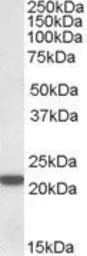Anti-PSMB8 antibody, C-term used in Western Blot (WB). GTX88410