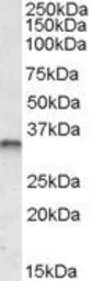 Anti-JunB antibody, Internal used in Western Blot (WB). GTX88411