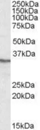 Anti-PPP4C antibody, C-term used in Western Blot (WB). GTX88412