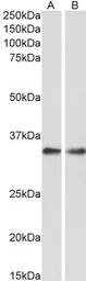 Anti-PPP4C antibody, C-term used in Western Blot (WB). GTX88412
