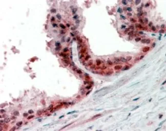 Anti-PPP4C antibody, C-term used in IHC (Paraffin sections) (IHC-P). GTX88412