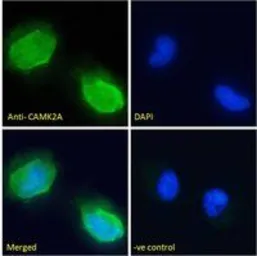 Anti-CaMKII alpha antibody, Internal used in Immunocytochemistry/ Immunofluorescence (ICC/IF). GTX88413
