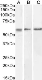Anti-CaMKII alpha antibody, Internal used in Western Blot (WB). GTX88413