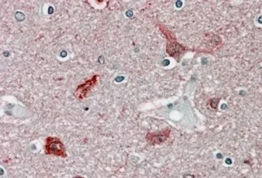Anti-CaMKII alpha antibody, Internal used in IHC (Paraffin sections) (IHC-P). GTX88413