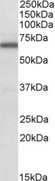 Anti-FMRP (aa116-130) antibody, Internal used in Western Blot (WB). GTX88417