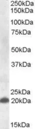 Anti-CD303 antibody, Internal used in Western Blot (WB). GTX88418