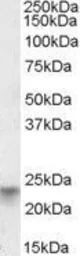 Anti-TM4SF3 / TSPAN8 antibody, Internal used in Western Blot (WB). GTX88421