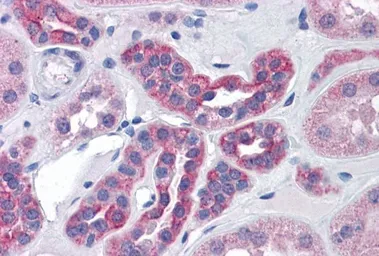 Anti-CENTG1 antibody, Internal used in IHC (Paraffin sections) (IHC-P). GTX88422