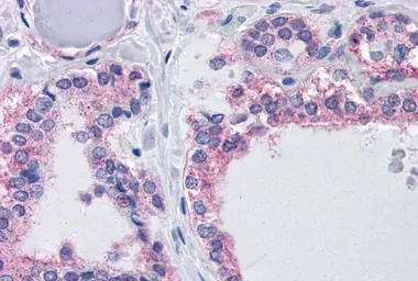 Anti-CENTG1 antibody, Internal used in IHC (Paraffin sections) (IHC-P). GTX88422
