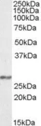 Anti-NDUFS3 antibody, Internal used in Western Blot (WB). GTX88423