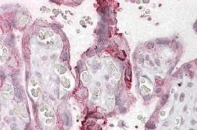 Anti-NCE2 antibody, C-term used in IHC (Paraffin sections) (IHC-P). GTX88427