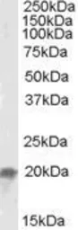 Anti-NCE2 antibody, C-term used in Western Blot (WB). GTX88427