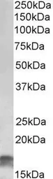 Anti-p14ARF (isoform 3) antibody, Internal used in Western Blot (WB). GTX88429