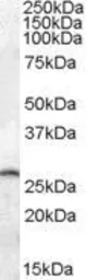 Anti-PSPH antibody, C-term used in Western Blot (WB). GTX88433