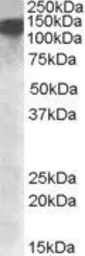 Anti-DHX9 antibody, Internal used in Western Blot (WB). GTX88436