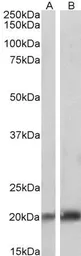 Anti-Caveolin 3 antibody, N-term used in Western Blot (WB). GTX88437
