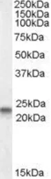 Anti-Caveolin 3 antibody, N-term used in Western Blot (WB). GTX88437