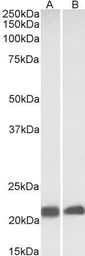 Anti-Caveolin 3 antibody, N-term used in Western Blot (WB). GTX88437