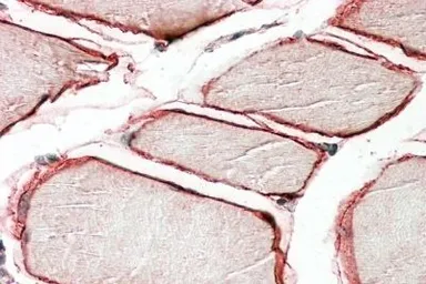Anti-Caveolin 3 antibody, N-term used in IHC (Paraffin sections) (IHC-P). GTX88437