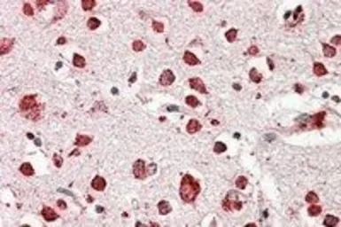 Anti-LIMP II antibody, Internal used in IHC (Paraffin sections) (IHC-P). GTX88440