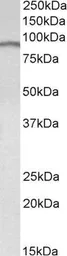 Anti-E2F7 antibody, Internal used in Western Blot (WB). GTX88444