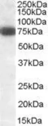 Anti-DLL1 antibody, Internal used in Western Blot (WB). GTX88445