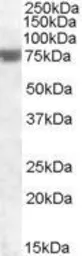 Anti-FEM1A antibody, C-term used in Western Blot (WB). GTX88449