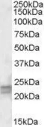 Anti-ARL4D antibody, Internal used in Western Blot (WB). GTX88455