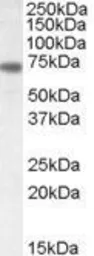 Anti-Netrin 1 antibody, C-term used in Western Blot (WB). GTX88460
