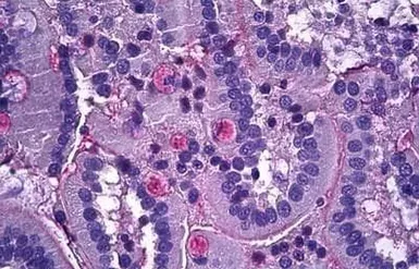 Anti-Netrin 1 antibody, C-term used in IHC (Paraffin sections) (IHC-P). GTX88460