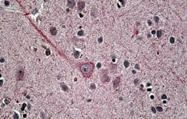 Anti-Synaptotagmin 1 antibody, Internal used in IHC (Paraffin sections) (IHC-P). GTX88461