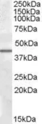 Anti-CaMKI delta antibody, C-term used in Western Blot (WB). GTX88464