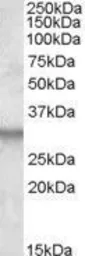 Anti-ITM2B antibody, Internal used in Western Blot (WB). GTX88466