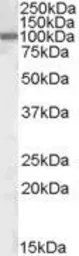 Anti-ZEB1 antibody, Internal used in Western Blot (WB). GTX88467