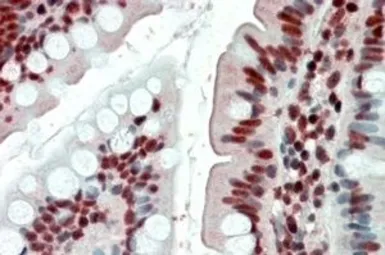 Anti-EWSR1 antibody, Internal used in IHC (Paraffin sections) (IHC-P). GTX88471