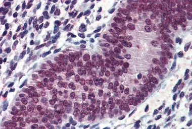 Anti-EWSR1 antibody, Internal used in IHC (Paraffin sections) (IHC-P). GTX88471