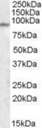 Anti-PCQAP / MED15 antibody, Internal used in Western Blot (WB). GTX88475