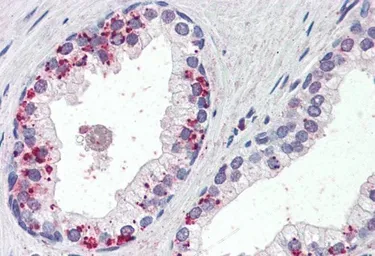 Anti-Annexin A1 antibody, C-term used in IHC (Paraffin sections) (IHC-P). GTX88476