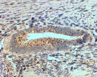 Anti-SFRP4 antibody, Internal used in IHC (Paraffin sections) (IHC-P). GTX88477