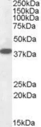 Anti-Laforin antibody, Internal used in Western Blot (WB). GTX88479