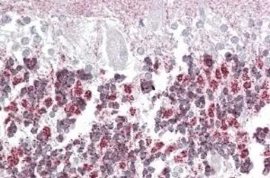 Anti-Laforin antibody, Internal used in IHC (Paraffin sections) (IHC-P). GTX88479