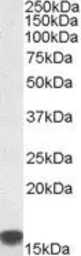 Anti-S100A9 antibody, Internal used in Western Blot (WB). GTX88481