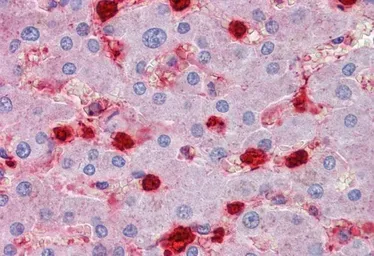 Anti-S100A9 antibody, Internal used in IHC (Paraffin sections) (IHC-P). GTX88481