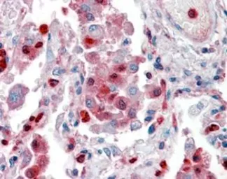 Anti-S100A9 antibody, Internal used in IHC (Paraffin sections) (IHC-P). GTX88481
