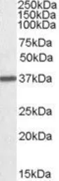 Anti-Arginase 1 antibody, C-term used in Western Blot (WB). GTX88484