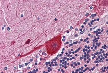 Anti-FKBP4 antibody, C-term used in IHC (Paraffin sections) (IHC-P). GTX88487