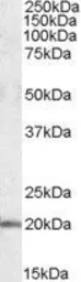 Anti-U2AF1L4 antibody, Internal used in Western Blot (WB). GTX88491