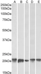 Anti-Ferritin Light Chain antibody, C-term used in Western Blot (WB). GTX88496