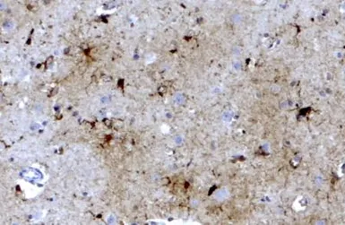 Anti-Ferritin Light Chain antibody, C-term used in IHC (Paraffin sections) (IHC-P). GTX88496